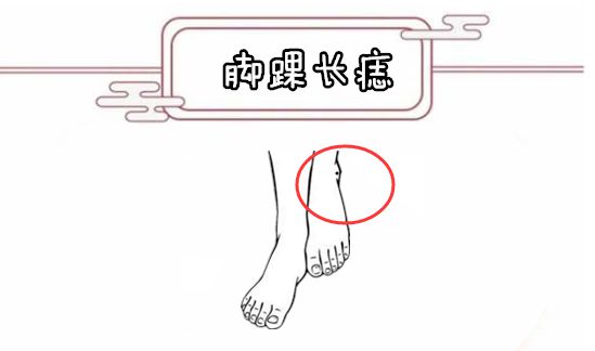 脚趾有痣代表什么图解图片